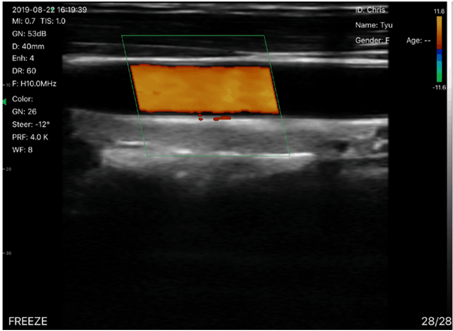 Medical Ultrasound Wireless Ultrasound Device Convex And Linear MUD-8000