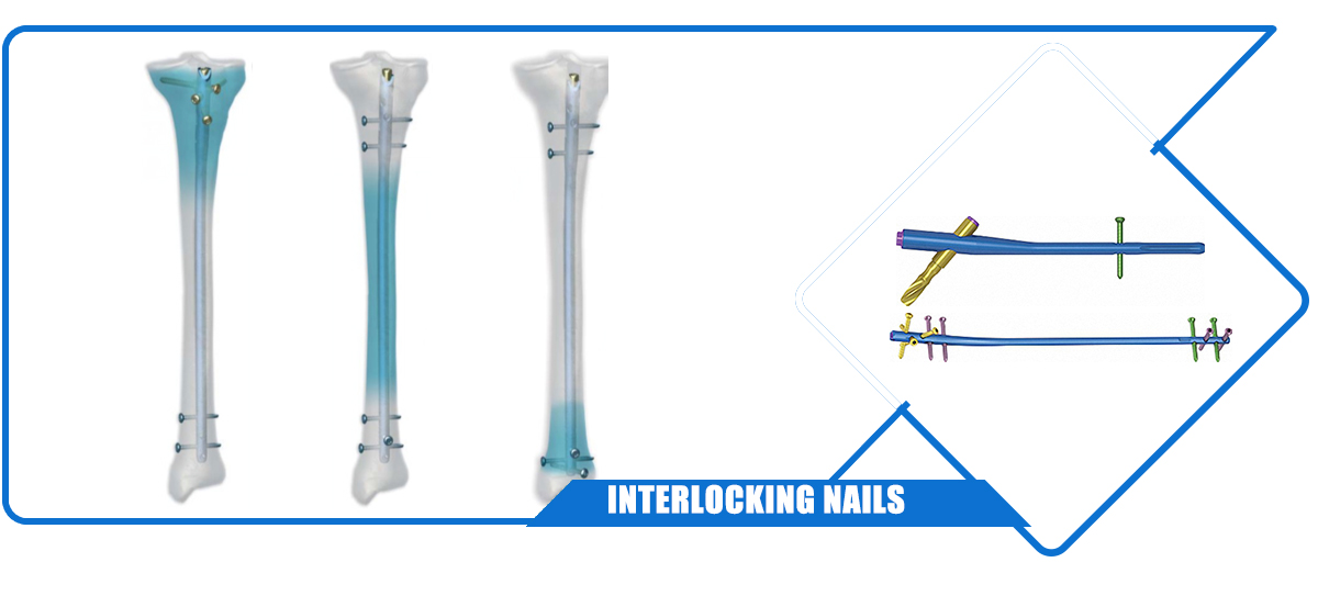 Instrument Sets For Intramedullary Nail Products Orthopedic Drills